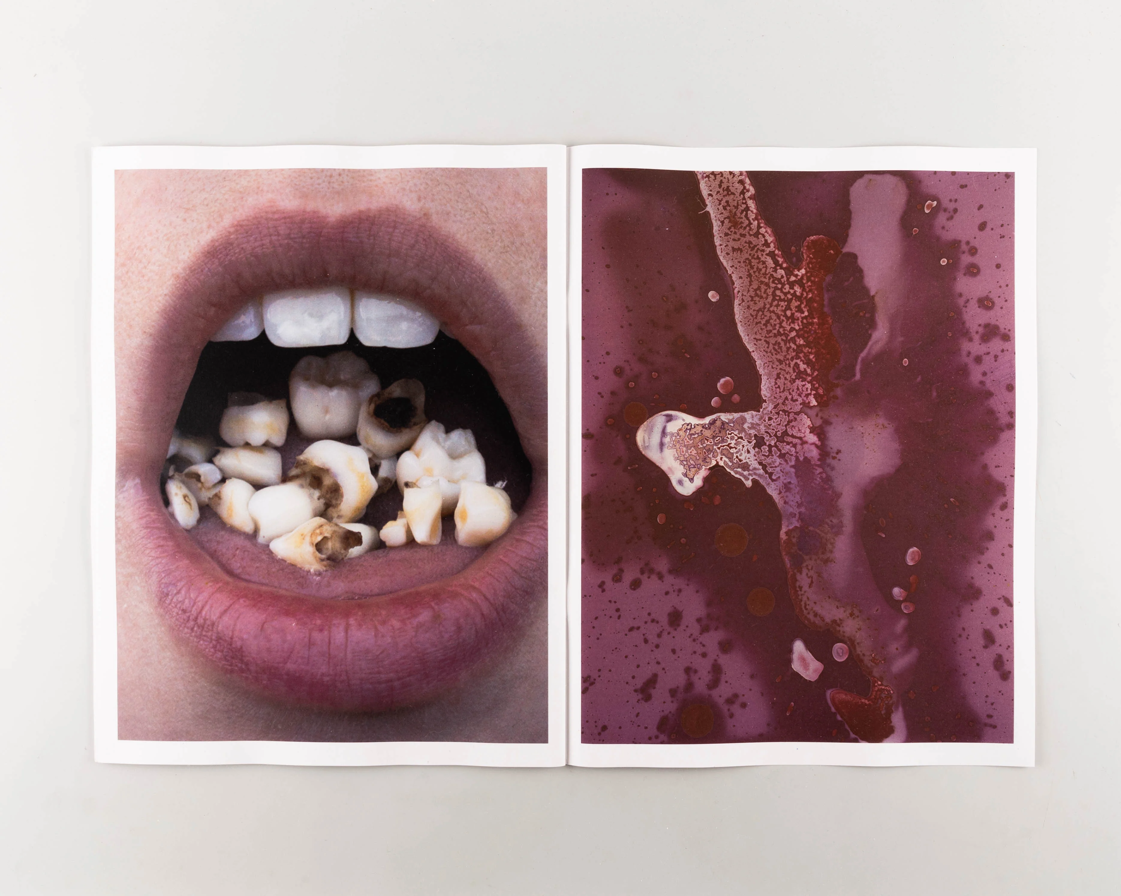A Cockroach Between Her Teeth - Image 3