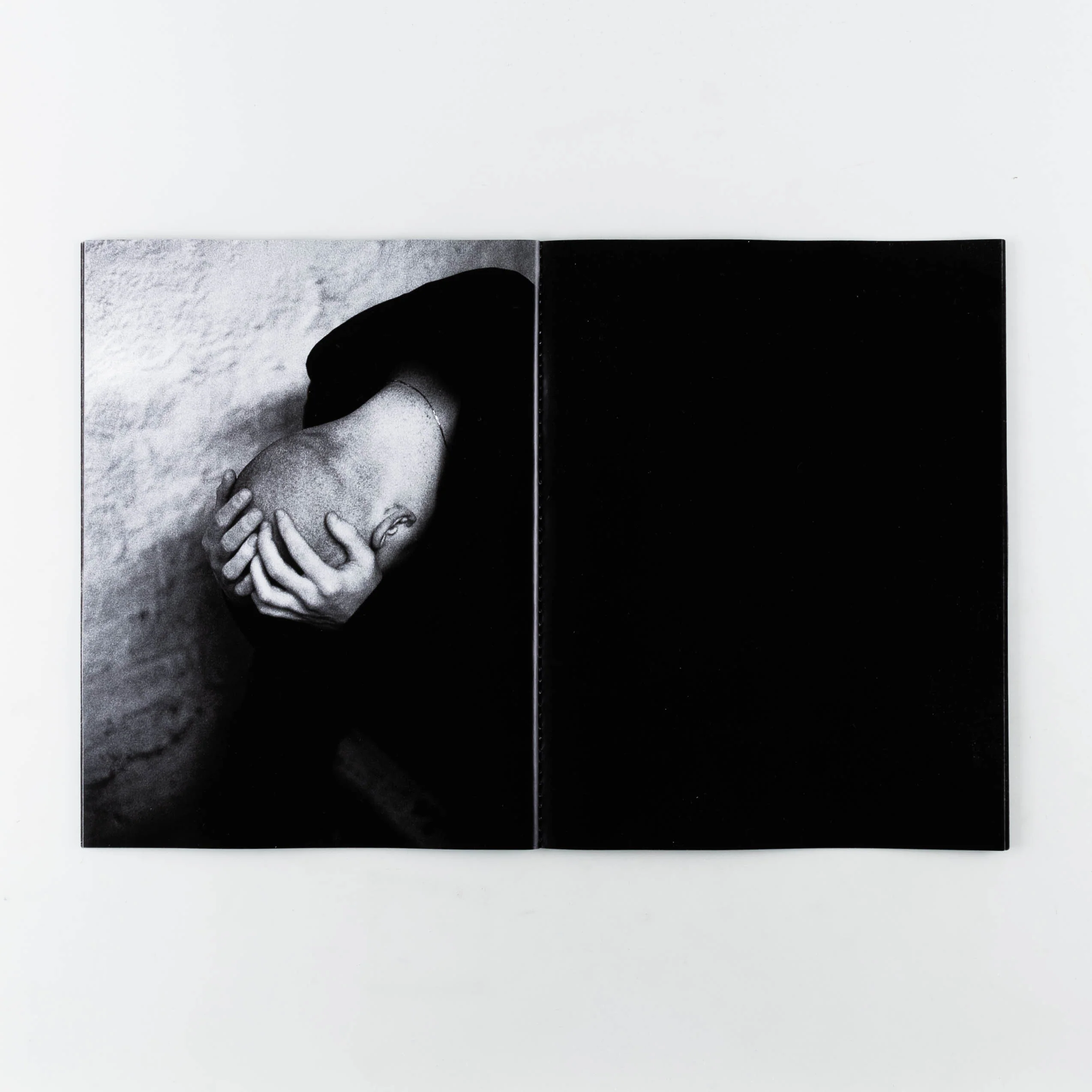 Bruxism - Image 2