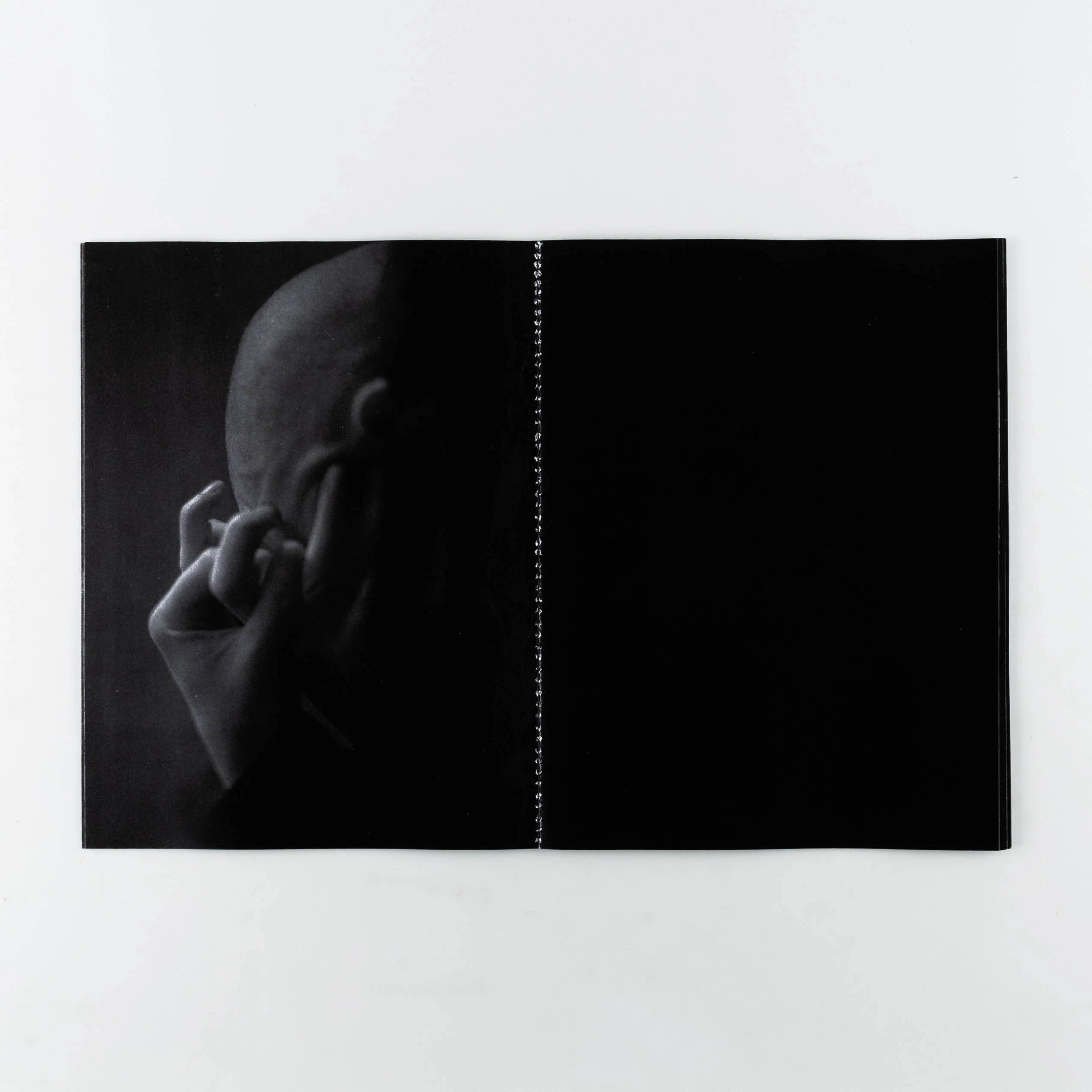 Bruxism - Image 4