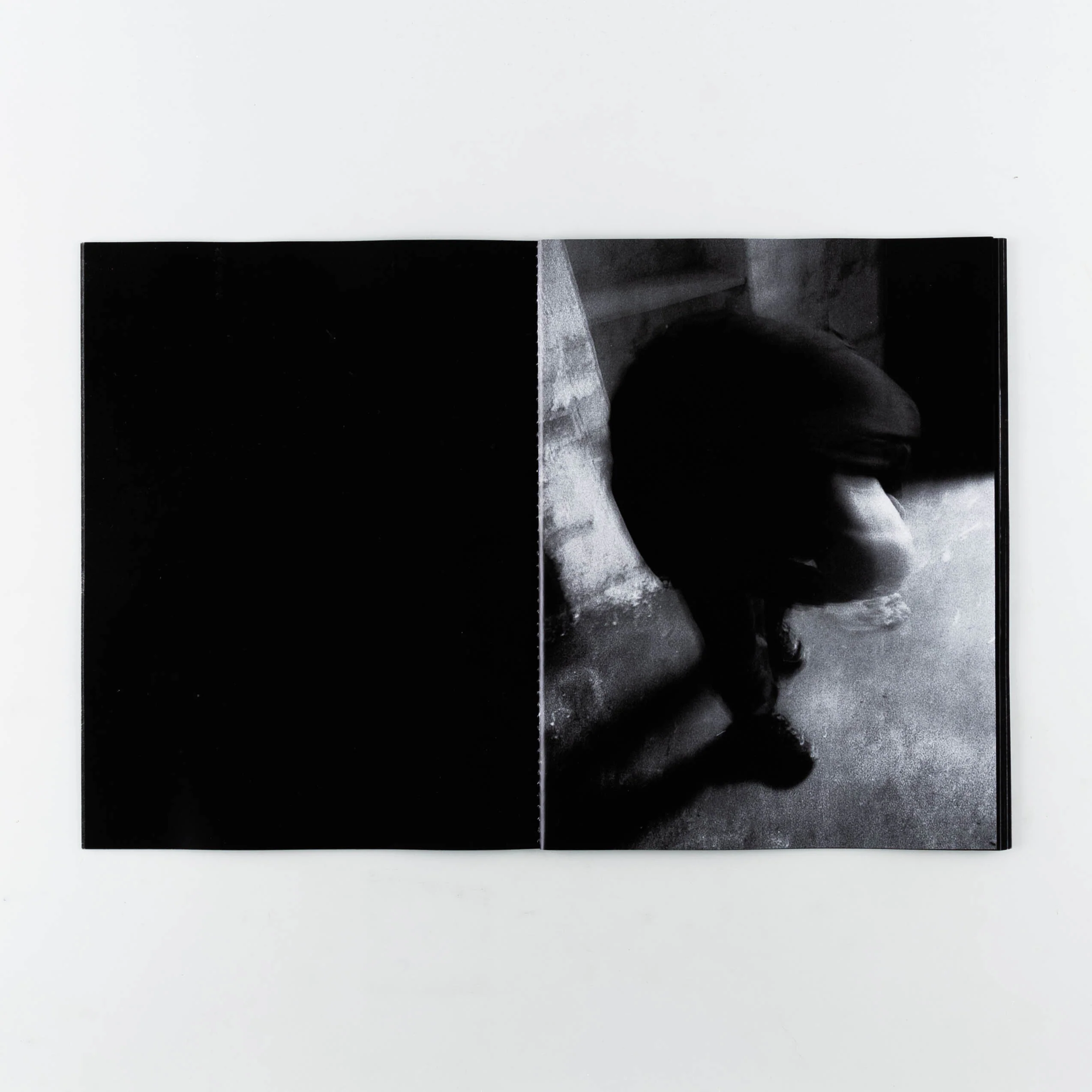 Bruxism - Image 6