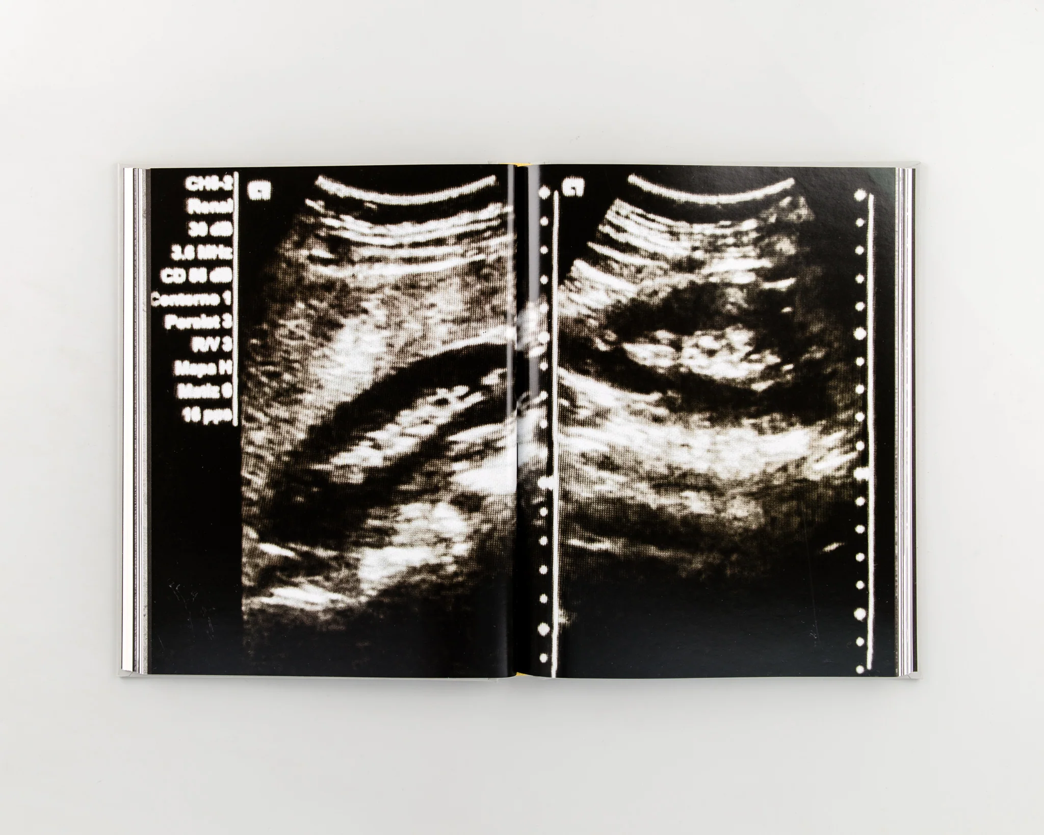 On Abortion - Image 3